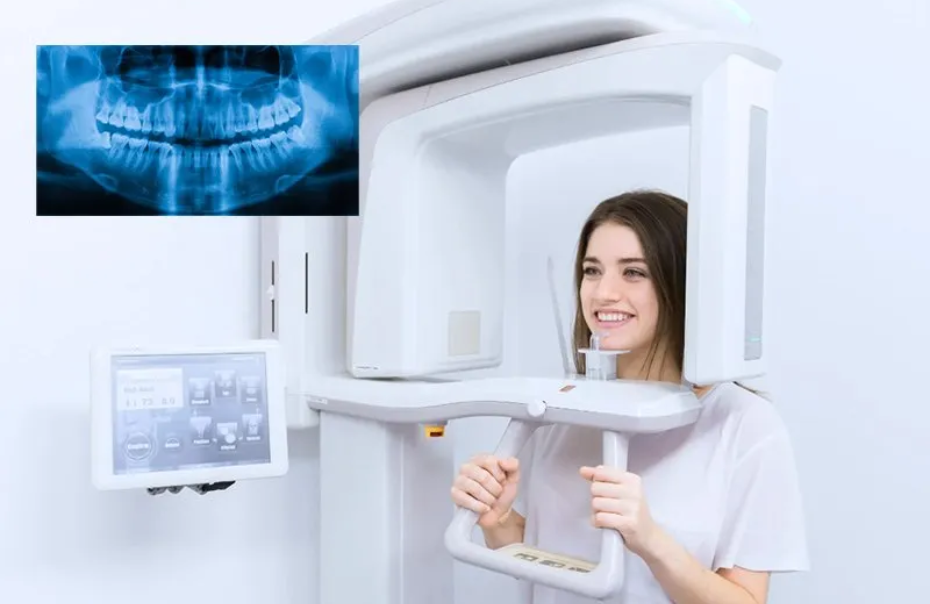 OPG panoramic dental X-ray sample image